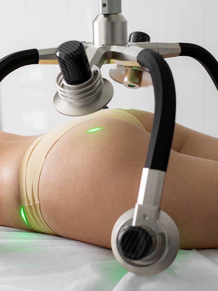 A woman undergoing laser liposuction in a modern medical clinic, showcasing high-tech equipment.